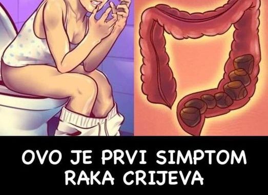 Ne sramite se, ODMAH DOKTORU! OVO JE PRVI SIMPTOM RAKA CRIJEVA:  Nikako ne zanemarujte, NIJE BEZAZLENO