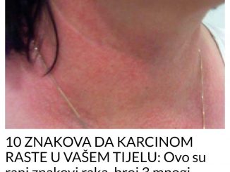 ORGANIZAM VAM ŠALJE PORUKU: 10 znakova da karcinom možda raste u vašem telu! Broj 4 mnogi zanemaruju!