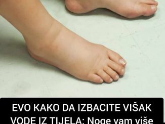 Da li ste primjetili duboke tragove od ne tako uskih čarapa