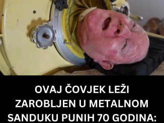 Dječija paraliza je bila ta koja je