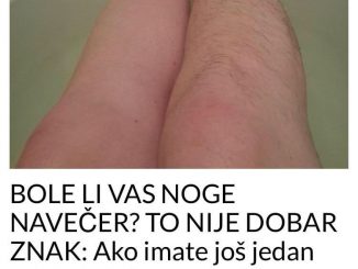 Proširene vene i varikoza ne daju uvijek jasno prepoznatljive simptome