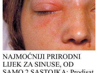 Donosimo vam dva prirodna recepta, koji će vam