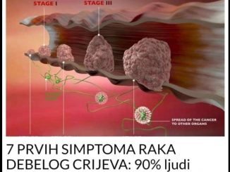 Rak debelog crijeva je jedan od najčešćih tipova karcinoma